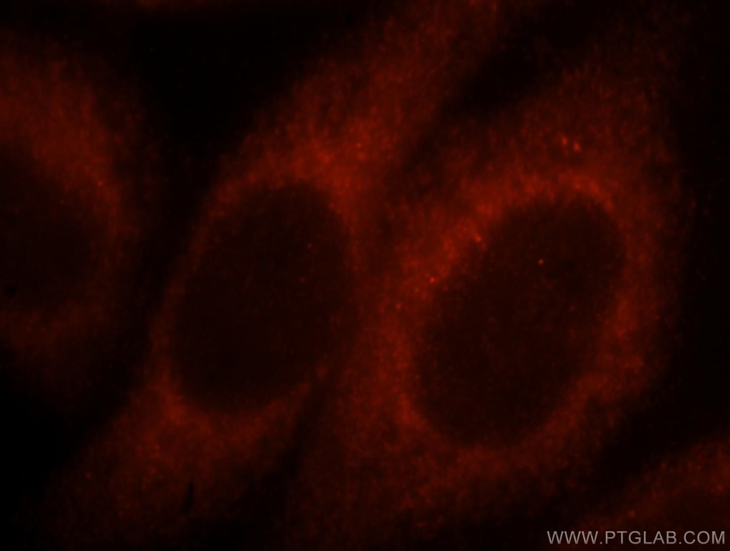 MYO1A Polyclonal antibody