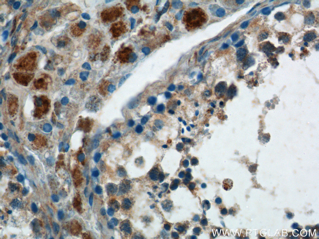 SPATA3 Polyclonal antibody