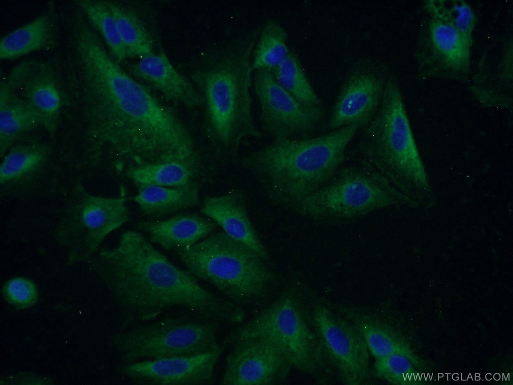 GSTCD Polyclonal antibody