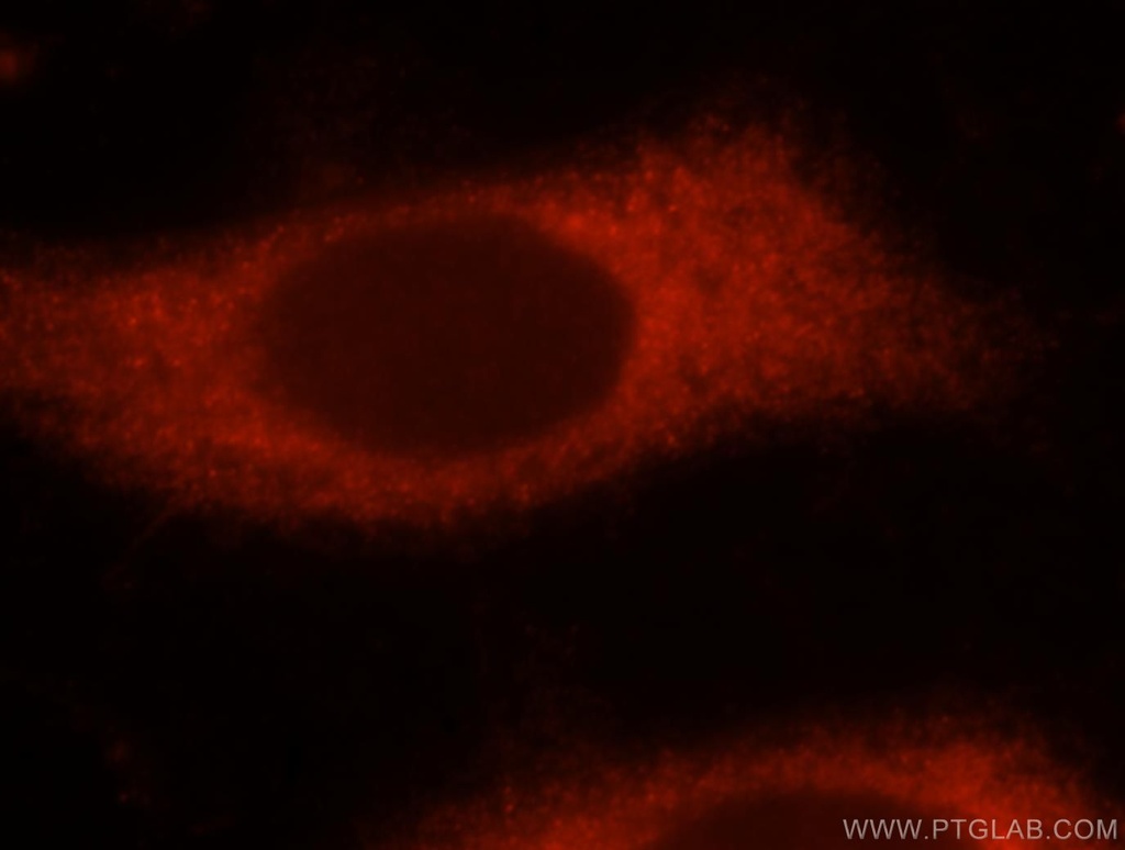 NUDT3/4/10/11 Polyclonal antibody