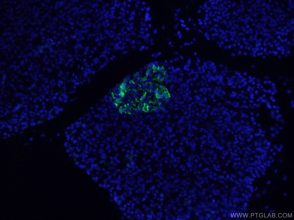 Somatostatin (64-81aa) Polyclonal antibody