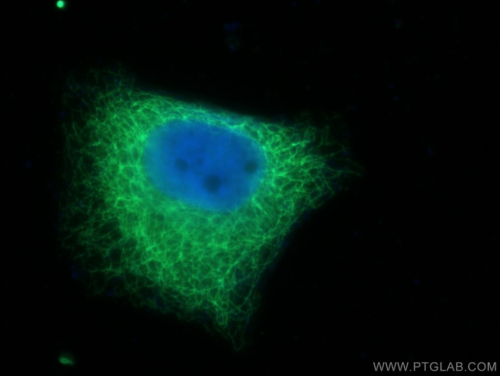 Cytokeratin 7-specific Polyclonal antibody