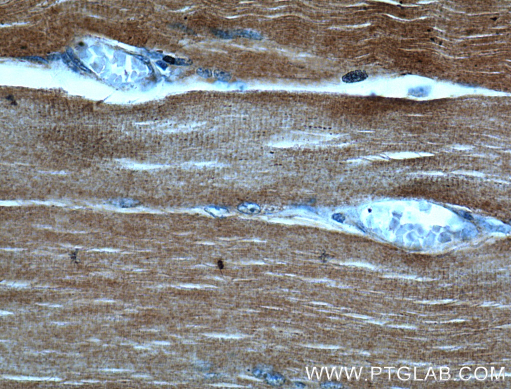 ACTA1-Specific Polyclonal antibody