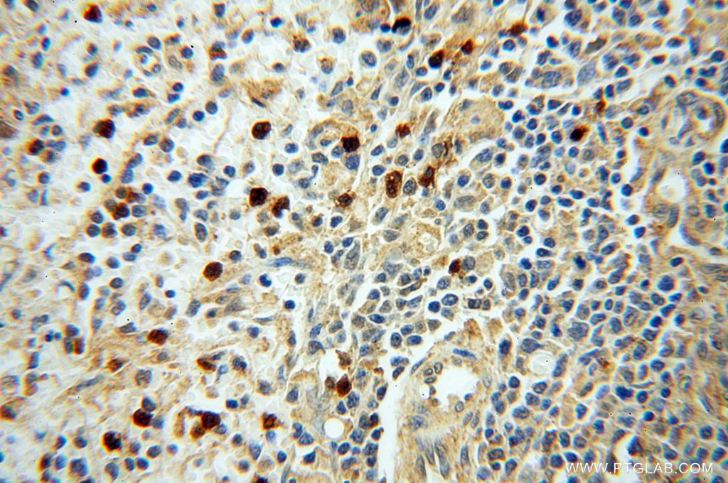 PARP9 Polyclonal antibody