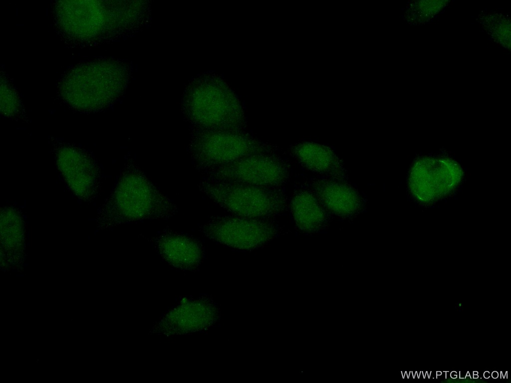 HDAC8 Polyclonal antibody