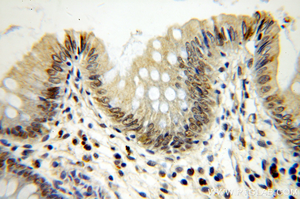 MTA2 Polyclonal antibody