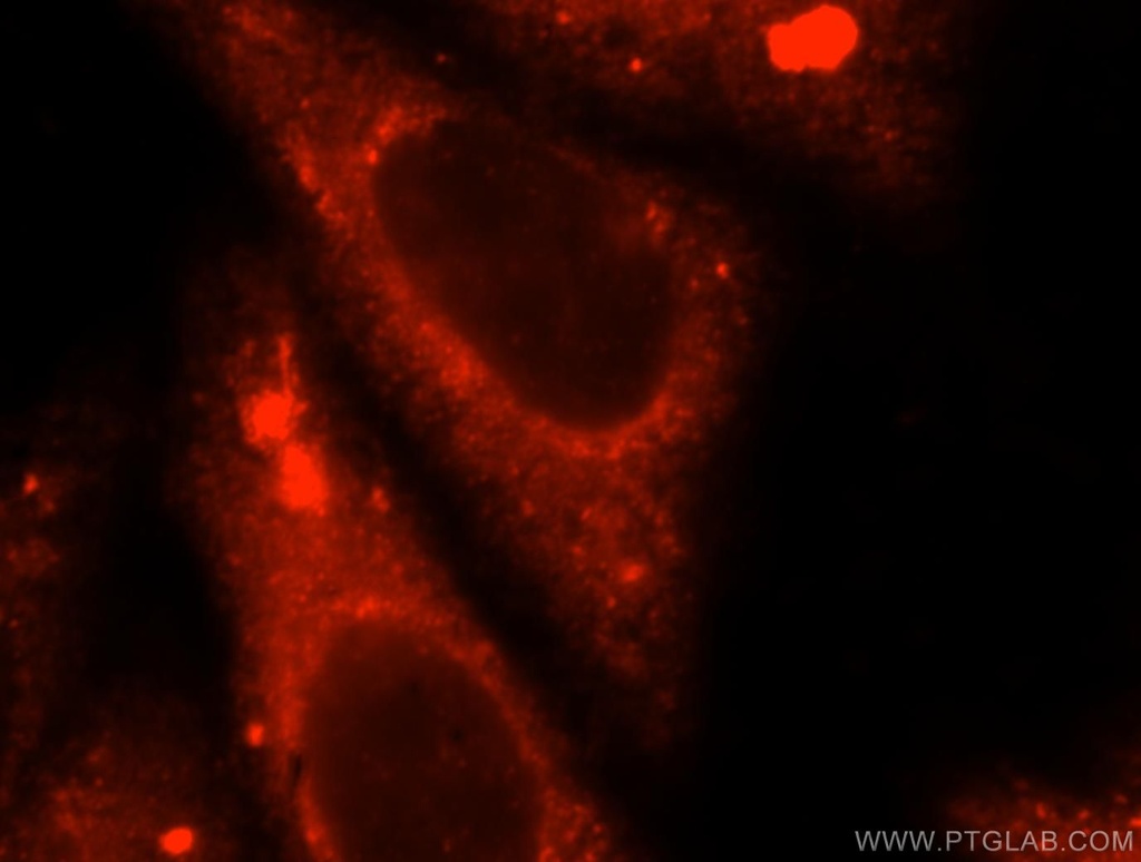TRMT11 Polyclonal antibody