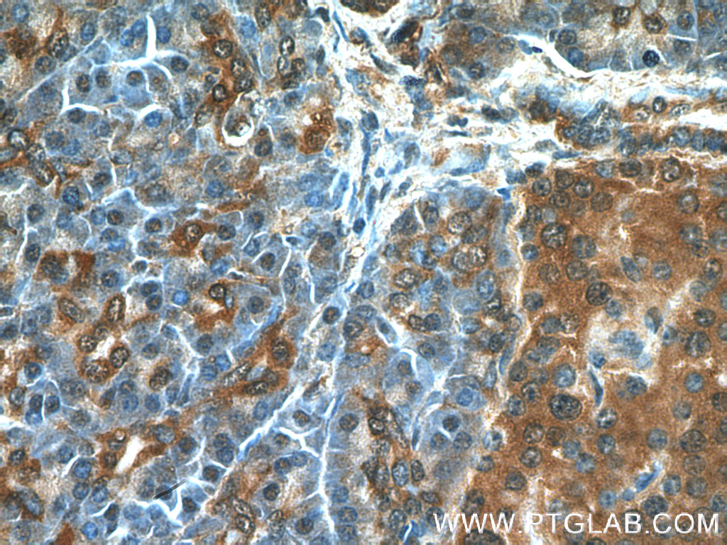 RIP3 Polyclonal antibody
