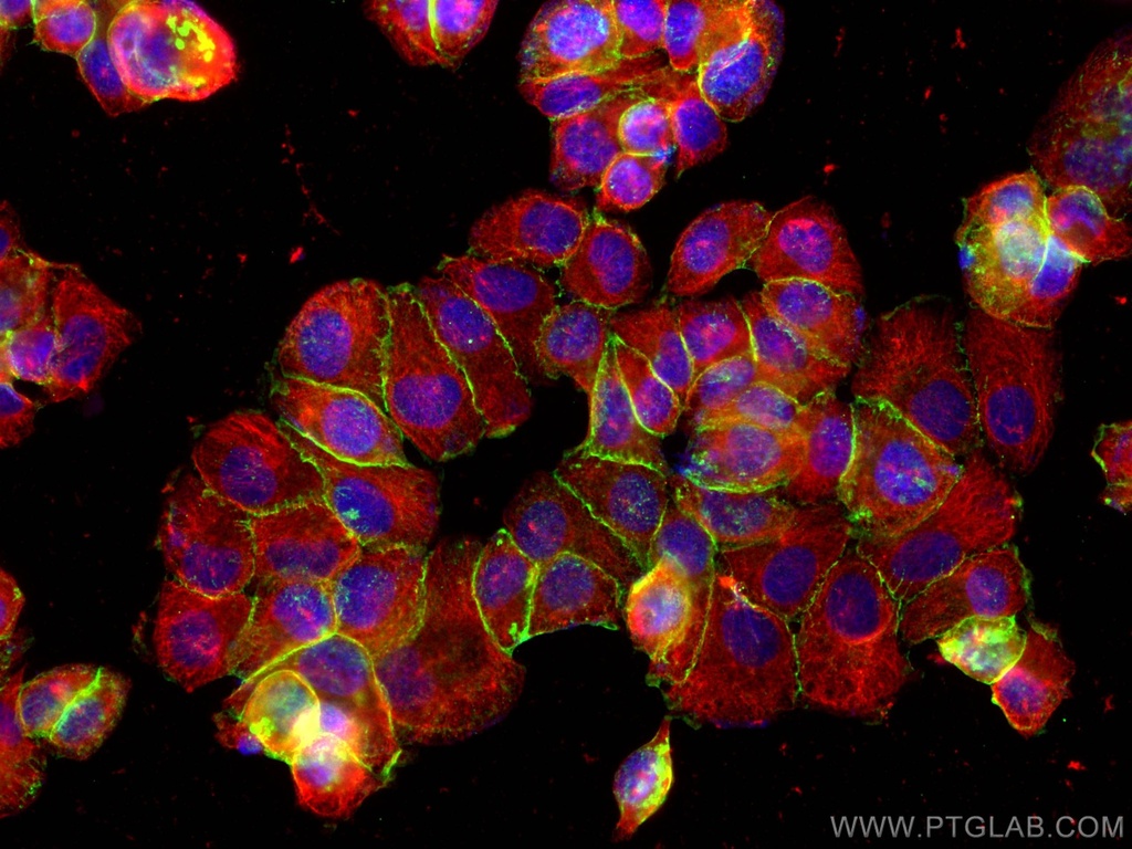 Beta Catenin Polyclonal antibody