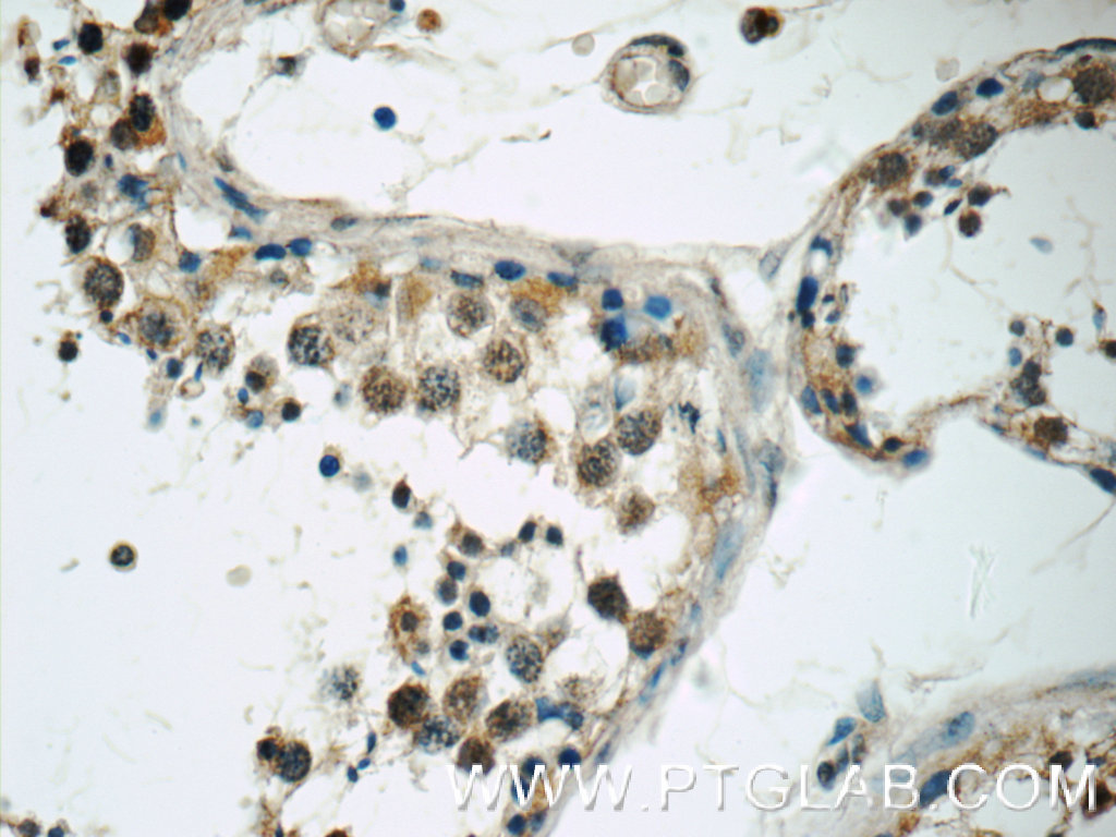 TSGA14 Polyclonal antibody