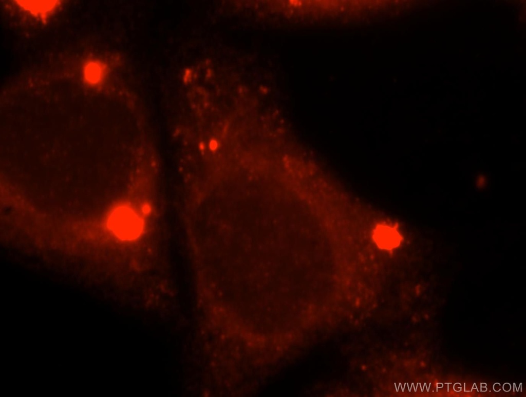 ACOX2 Polyclonal antibody