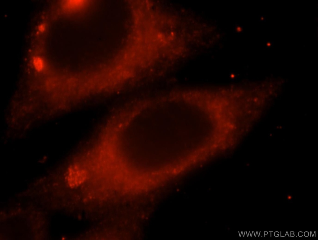 MAPK10 Polyclonal antibody