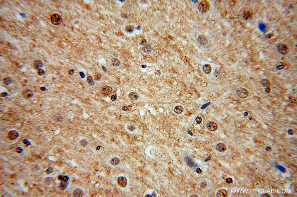 MDM1 Polyclonal antibody