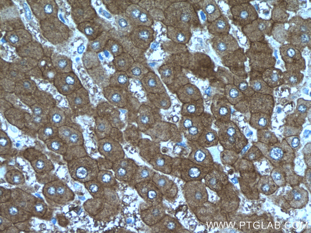 PKLR Polyclonal antibody