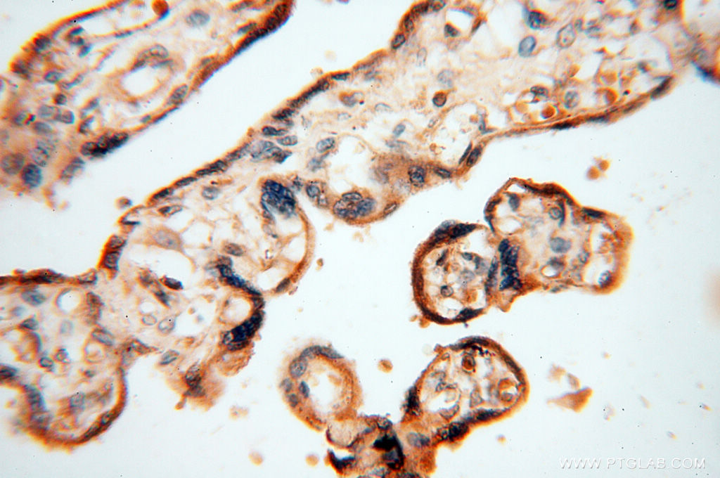 HRASLS5 Polyclonal antibody