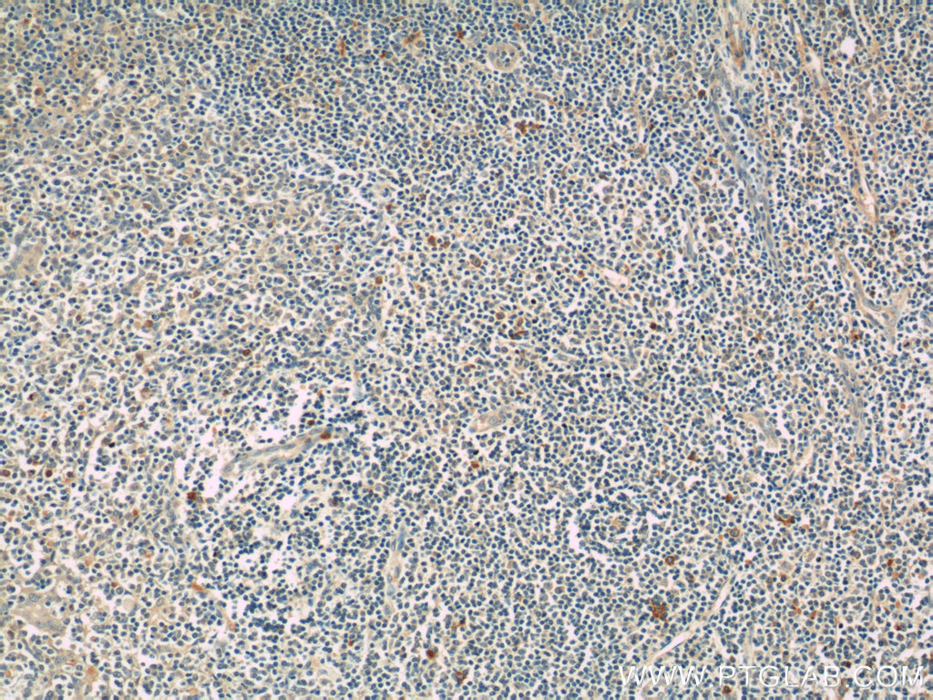 KIR3DX1 Polyclonal antibody