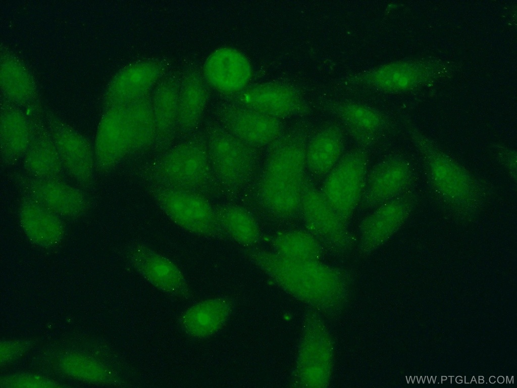 BXDC1 Polyclonal antibody