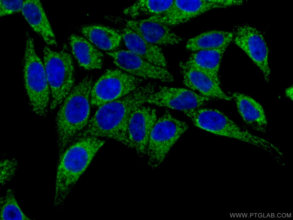 ATP5H Polyclonal antibody