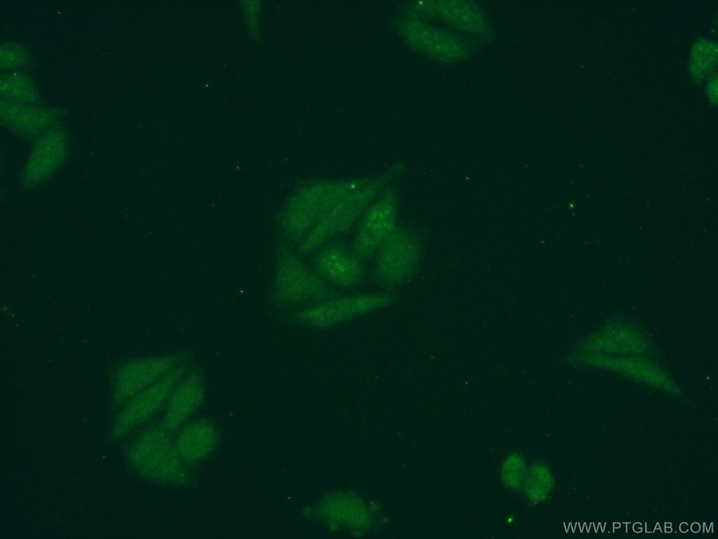 DDX43 Polyclonal antibody