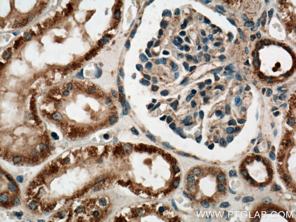 PYK2 Polyclonal antibody