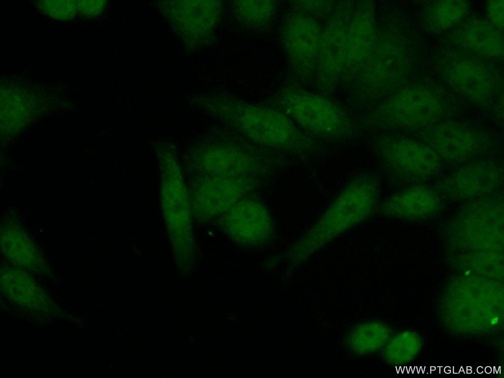 FIGNL1 Polyclonal antibody