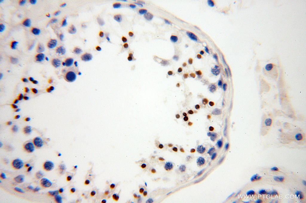 HEMGN Polyclonal antibody