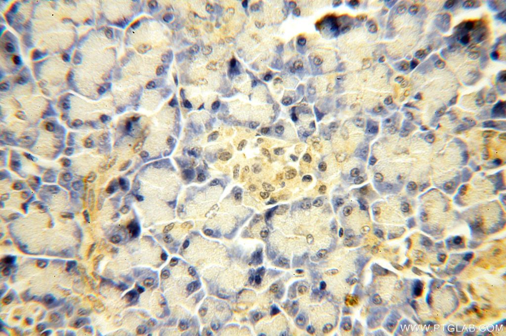 SBDS Polyclonal antibody