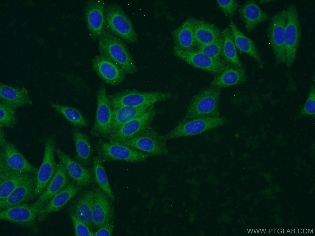 EHBP1 Polyclonal antibody