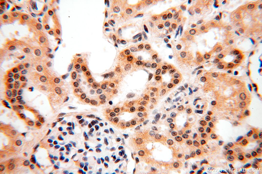 PGBD3 Polyclonal antibody