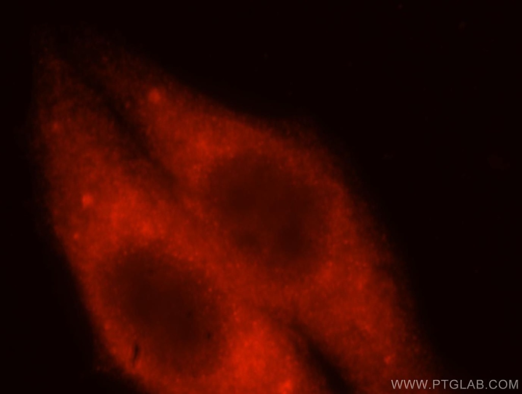 HMGCS1 Polyclonal antibody