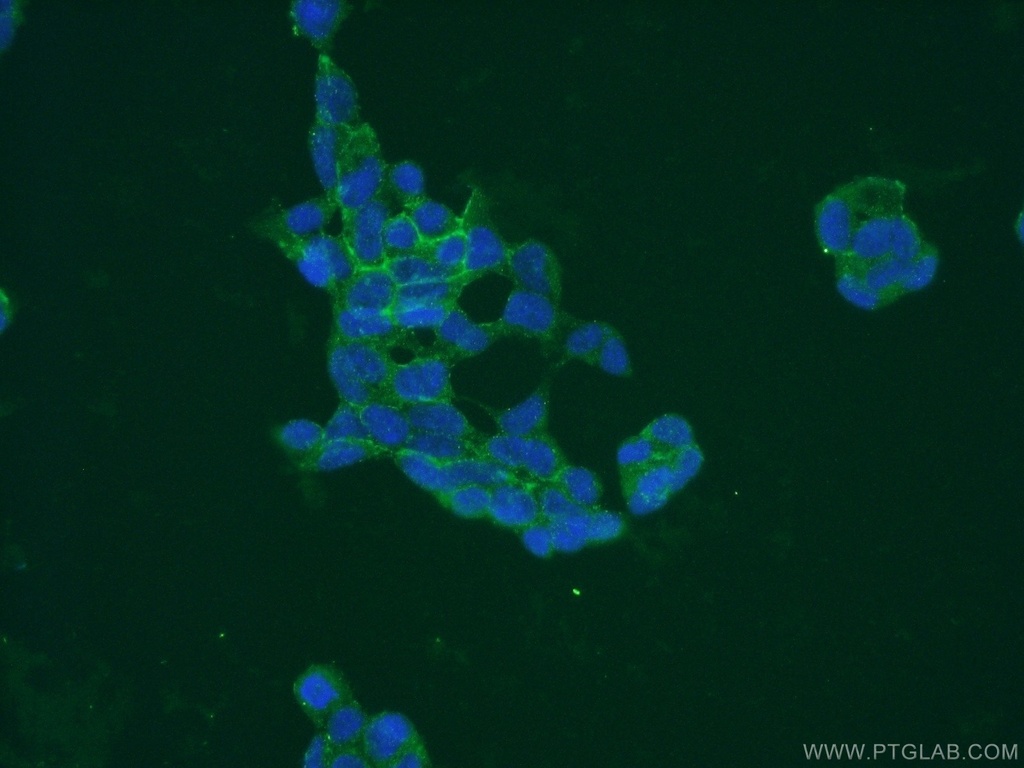 PAAF1 Polyclonal antibody
