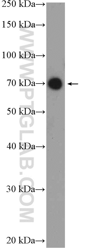 UTP6 Polyclonal antibody