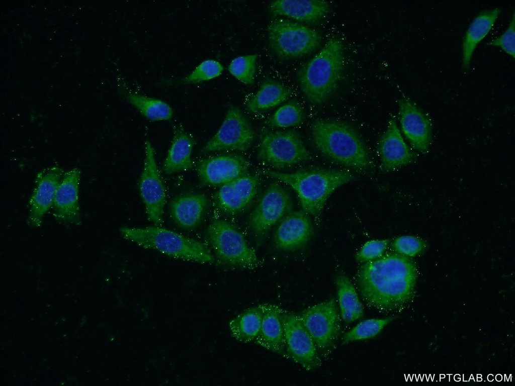HNRNPH3 Polyclonal antibody
