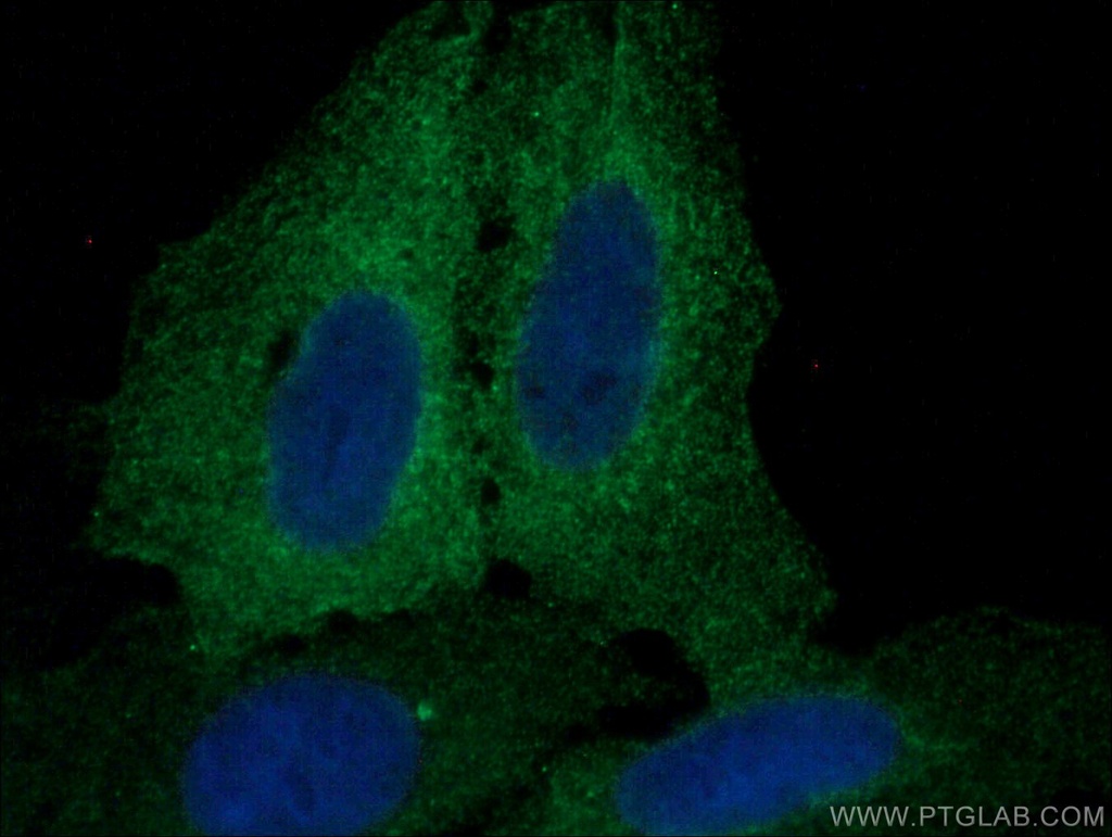 AHNAK2 Polyclonal antibody