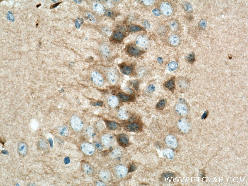 VEZT Polyclonal antibody
