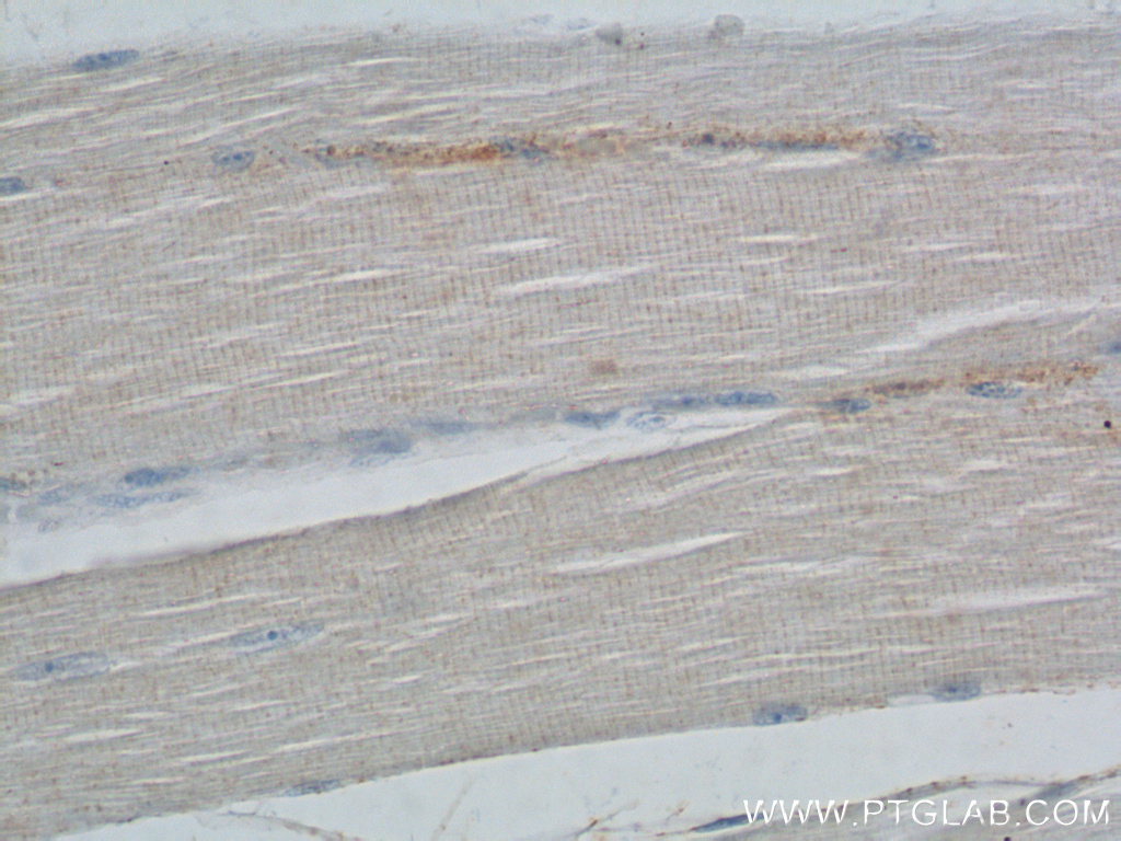 MYOM3 Polyclonal antibody