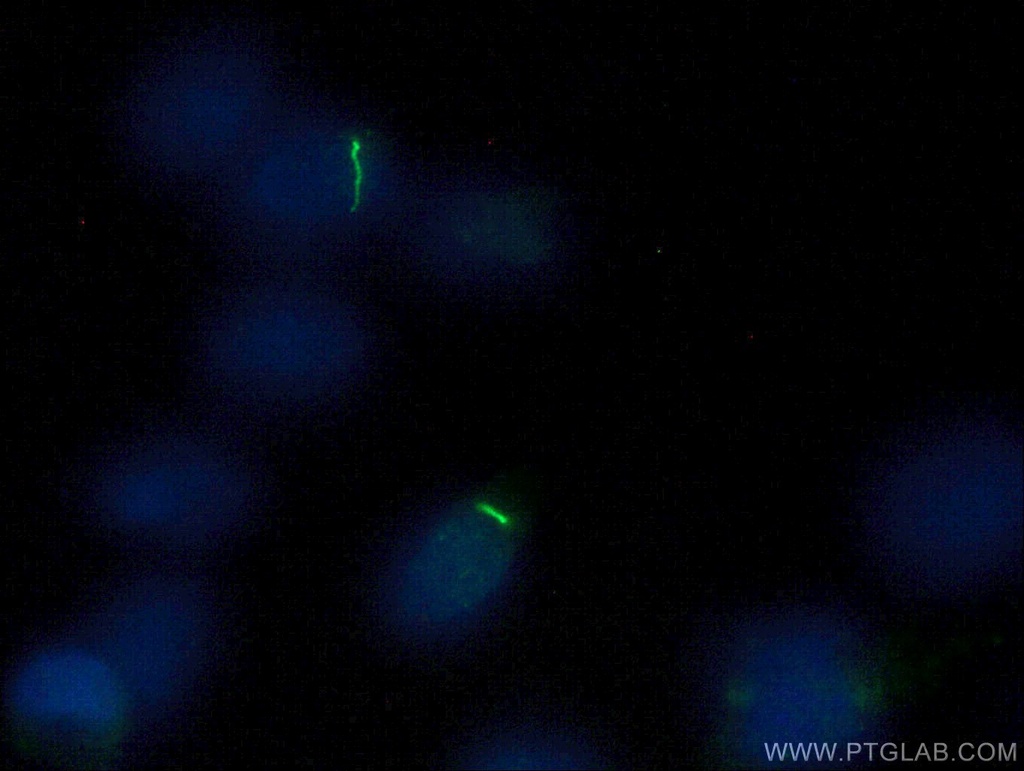 ARL13B Polyclonal antibody