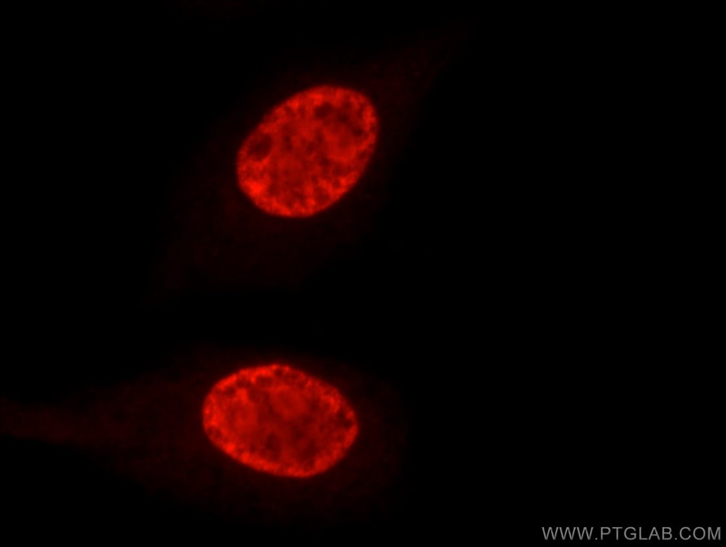 DHX9 Polyclonal antibody