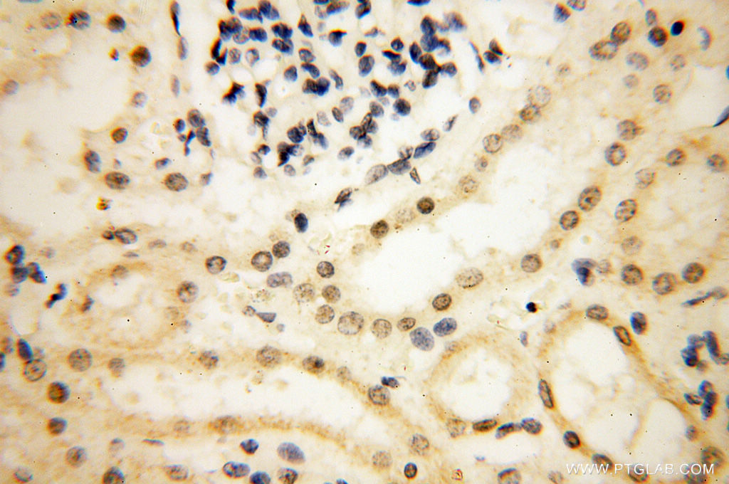 SMARCC1 Polyclonal antibody