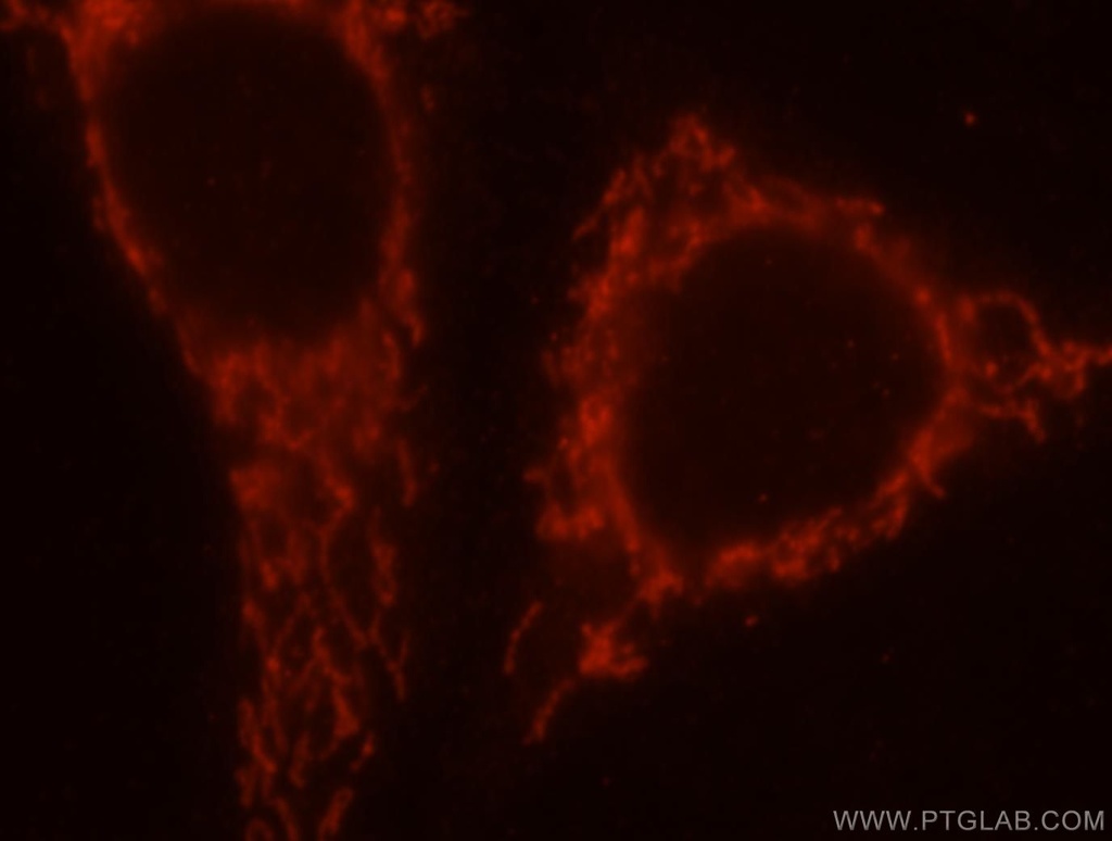SAMD4B Polyclonal antibody