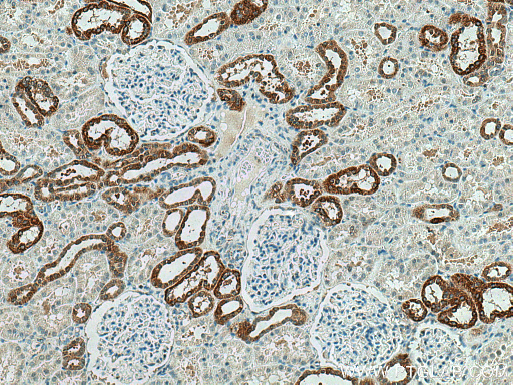 PRX5 Polyclonal antibody
