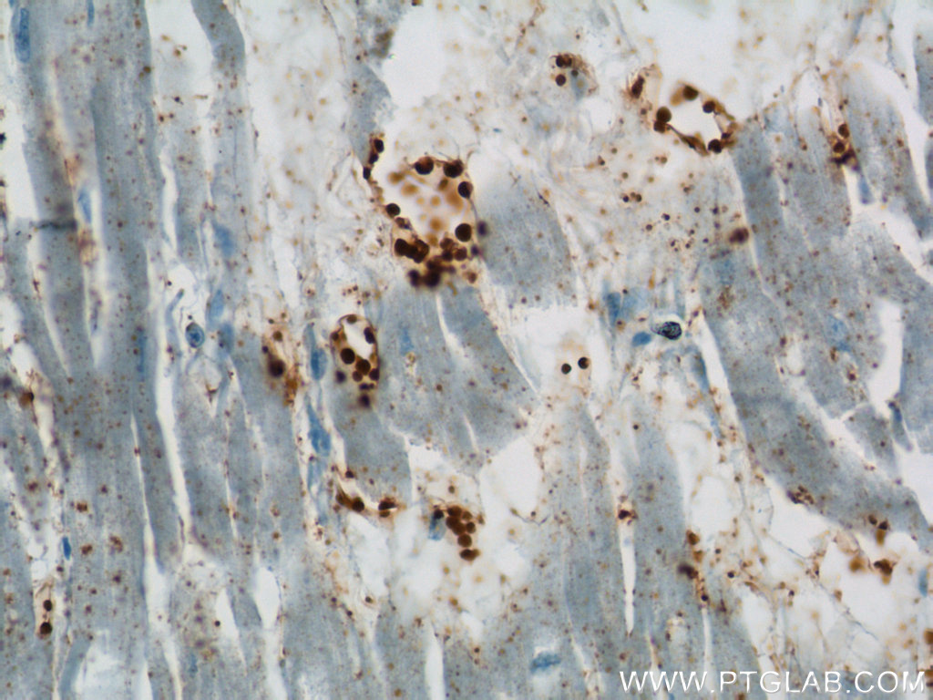 BLVRB Polyclonal antibody