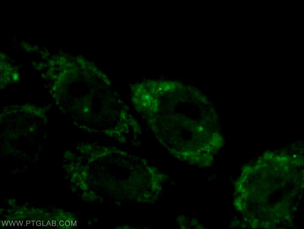 CPSF2 Polyclonal antibody