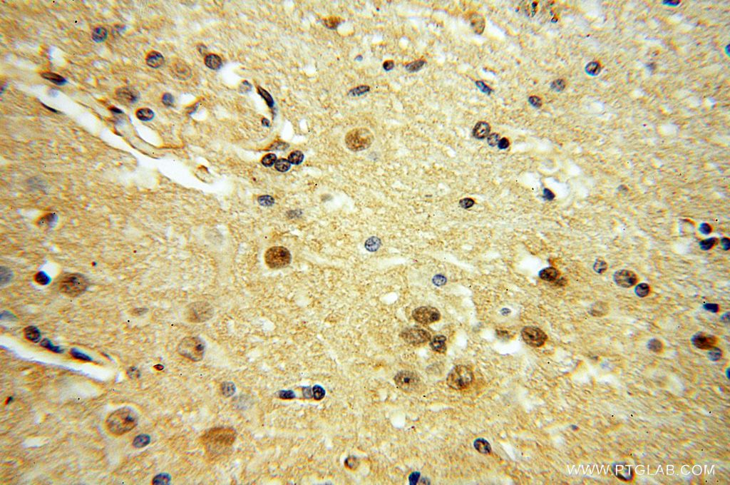 YPEL1 Polyclonal antibody