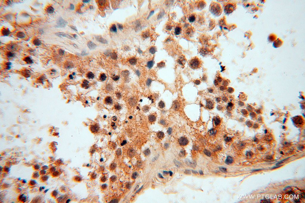 LSG1 Polyclonal antibody