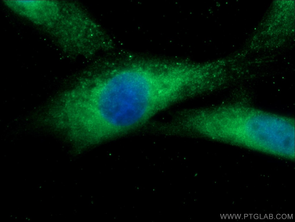 RANBP9 Polyclonal antibody