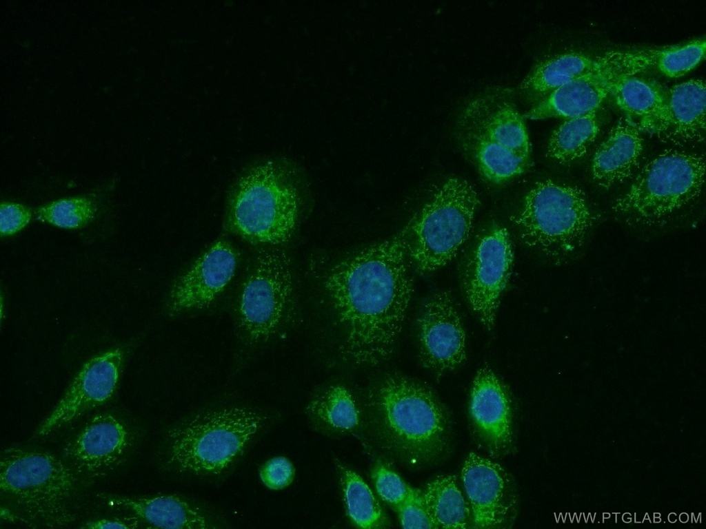 CNDP1 Polyclonal antibody