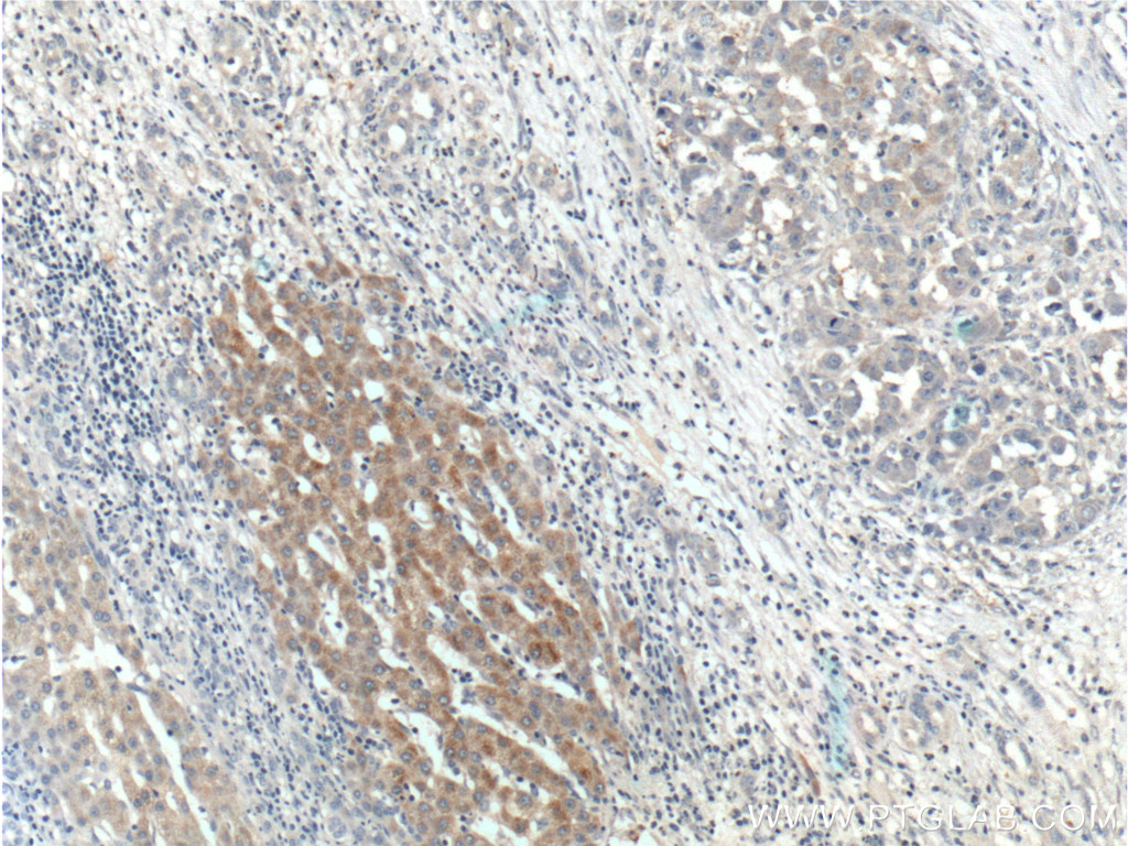 BMP9 Polyclonal antibody