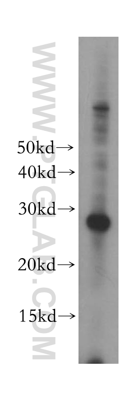 ORC6 Polyclonal antibody