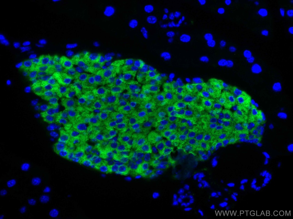 Synaptophysin Polyclonal antibody
